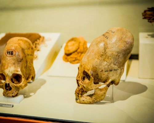 Ancient Deformed Skulls at the Ica Regional Museum - Peru